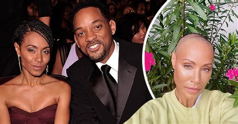 will smith wife hair loss