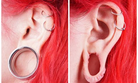 Will Stretched Ears Close Up Overnight
