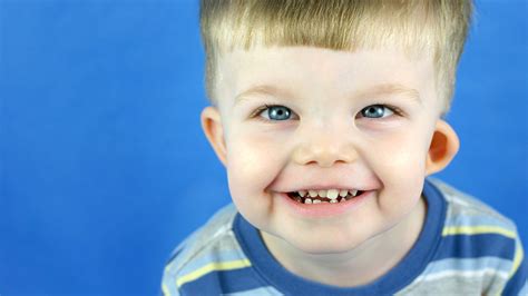 William Disorder Symptoms