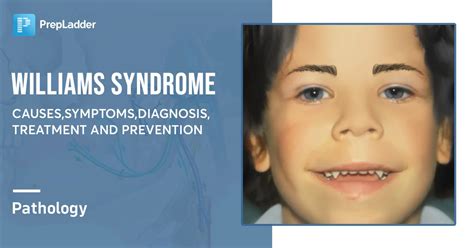 Williams Syndrome Disorder Facts