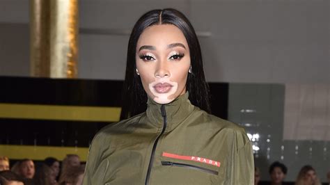 winnie harlow height in cm