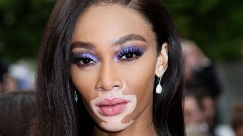 winnie harlow history