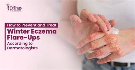 Winter eczema: Unexpected triggers? Find out!