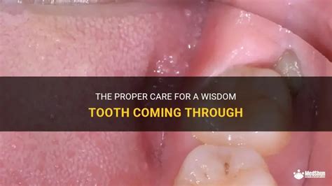 wisdom coming through