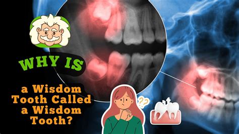 wisdom tooth reason