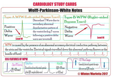 wolf parkinson's white syndrome management