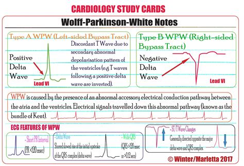 wolff parkinson white prognosis