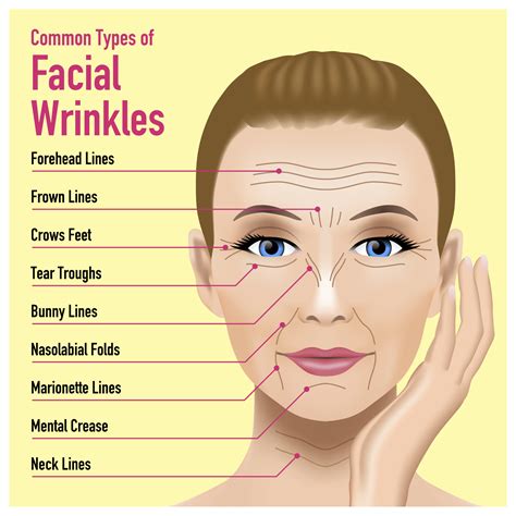 Wrinkles