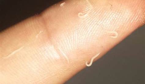 Dieser fleischfressende Wurm bedroht Regenwürmer