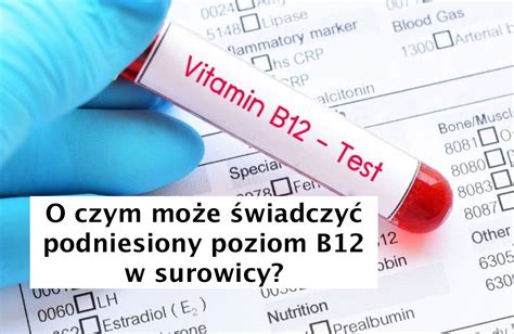 wysoki poziom witaminy b12