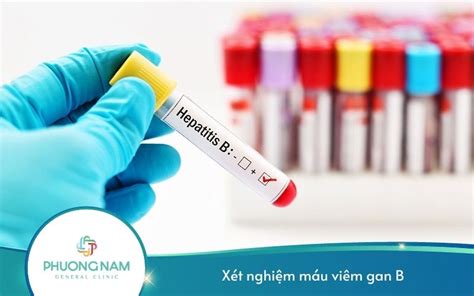 xét nghiệm máu viêm gan b