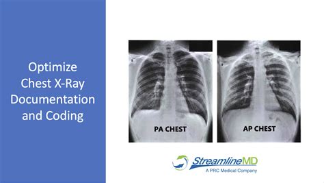 x ray exam chest 1 view cpt code