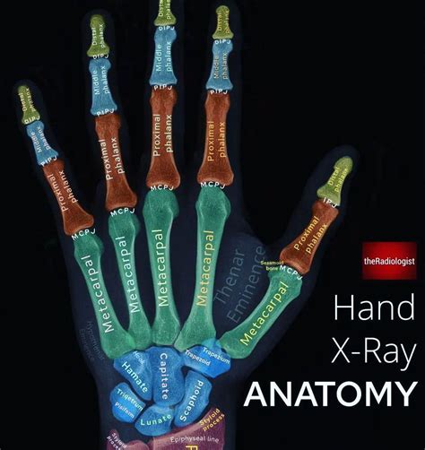 X Ray Hand Labeled