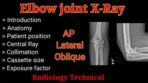 X Ray Position Of Elbow Joint