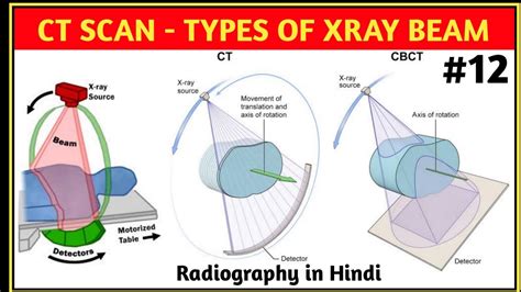 X-Ray Beam Size