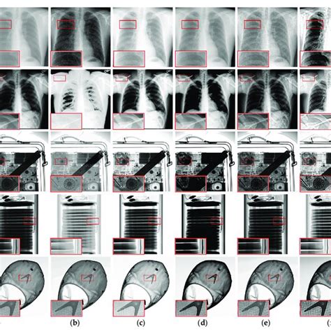 X-Ray Image Enhancement Algorithm