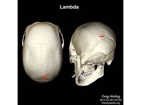 X-Ray Lambda@Edge