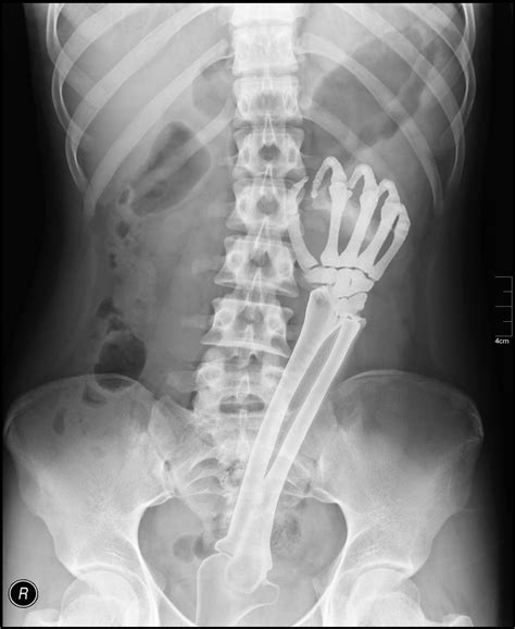 xray porn