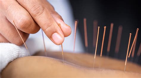 Yang Acupuncture Denver