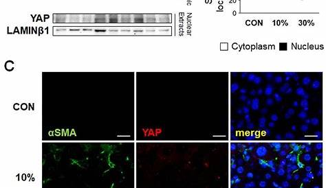 YAP signaling in gastric cancer-derived mesenchymal stem cells is