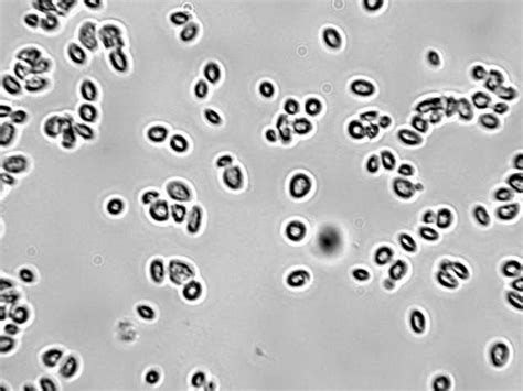 yeast under a microscope