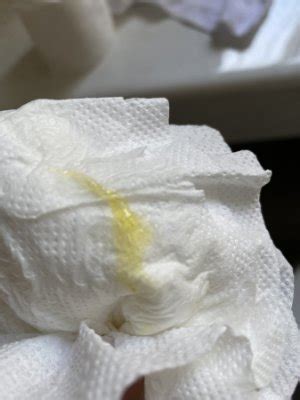 Understanding Yellow Discharge Postpartum: Causes and Concerns