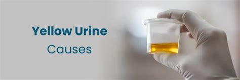 Yellow Staining Urine