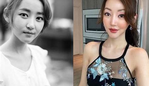 Unveiling The Truth: Yeonmi Park's Plastic Surgery Journey