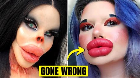 youtube plastic surgery gone bad