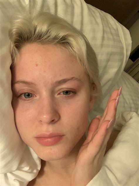 zara larsson no makeup