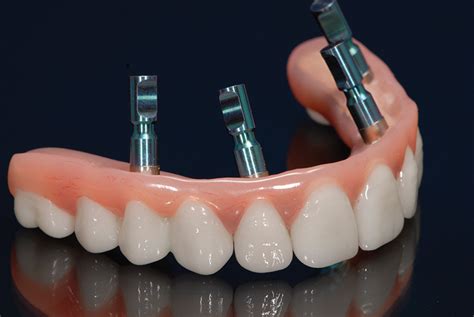 Zirconia Implants Vs Hybrid