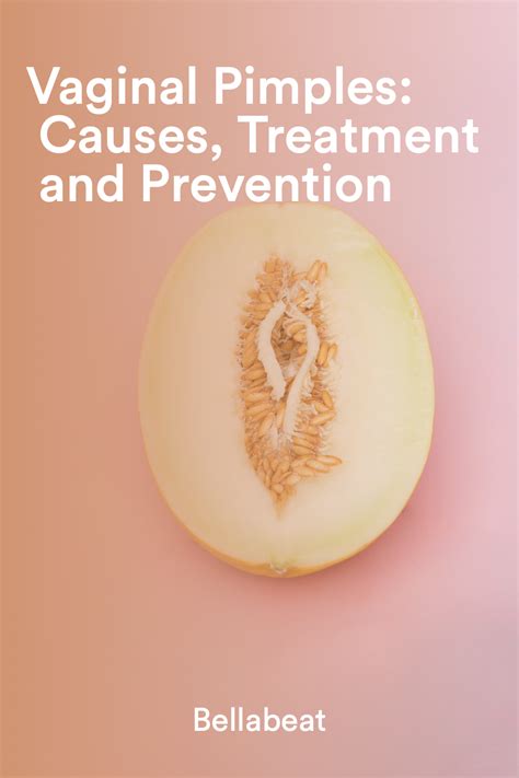 Understanding and Managing Zits on Labia: Causes, Symptoms, and Treatment Options