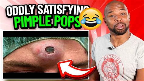 zit popping youtube