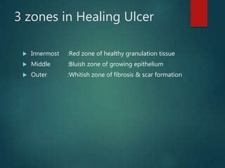 What Is A Zone Of Ulcer And How Does It Heal