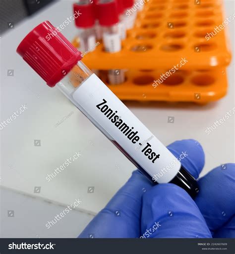 Zonisamide Drug Test