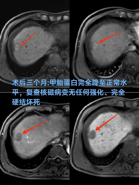 普美显磁共振