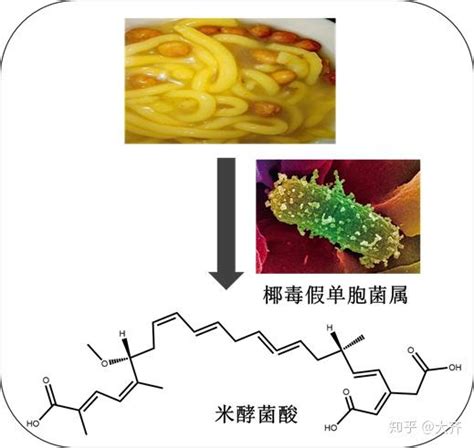 米酵菌酸中毒案例分析